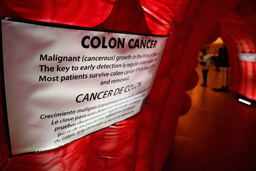 colon cancer model